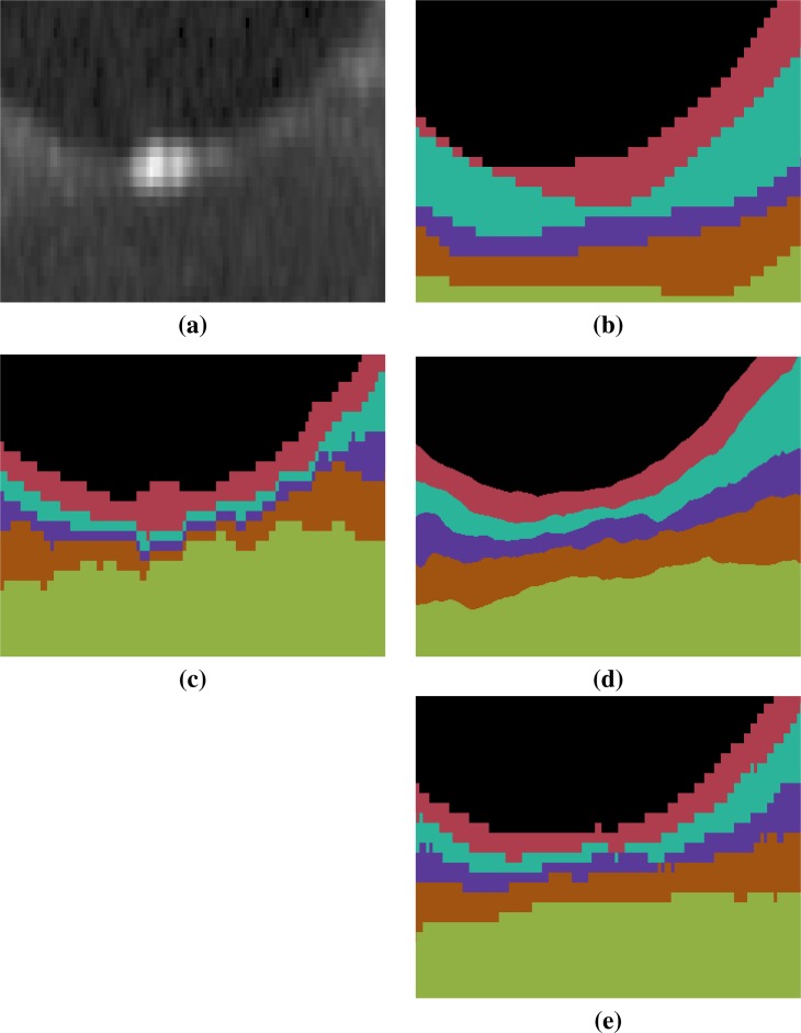 MGDMOCT Figure 4.jpg