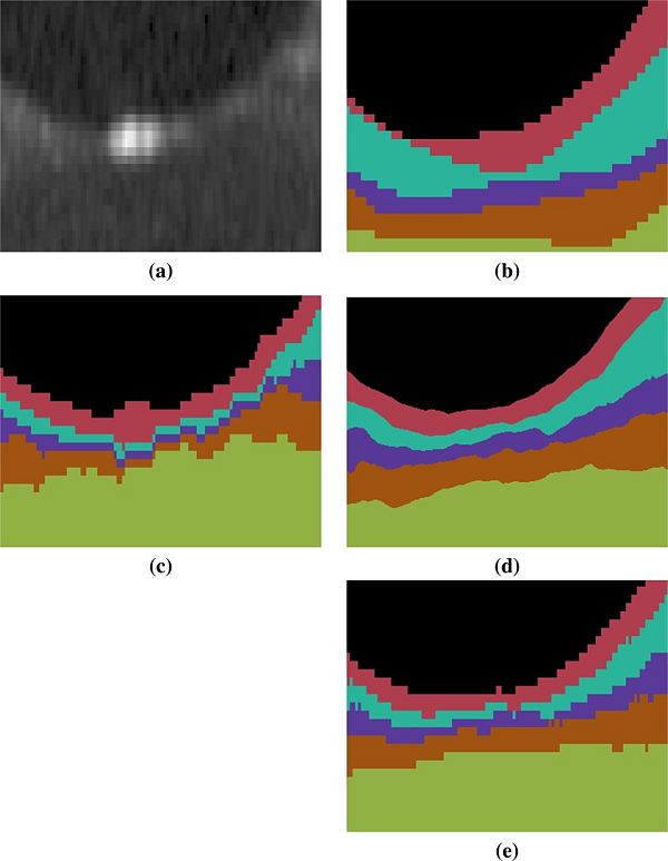 MGDMOCT Figure 4.jpg