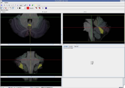 Lobule8a1.PNG