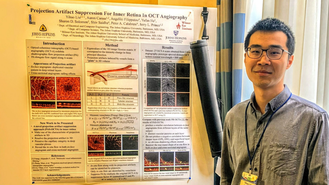 Yihao Liu presenting a poster at ISBI 2019.