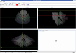 Lobule 12b.PNG