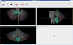 Lobe9d.PNG